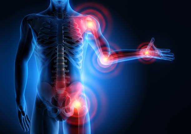 How to Reduce Inflammation Naturally – Best Foods and Habits